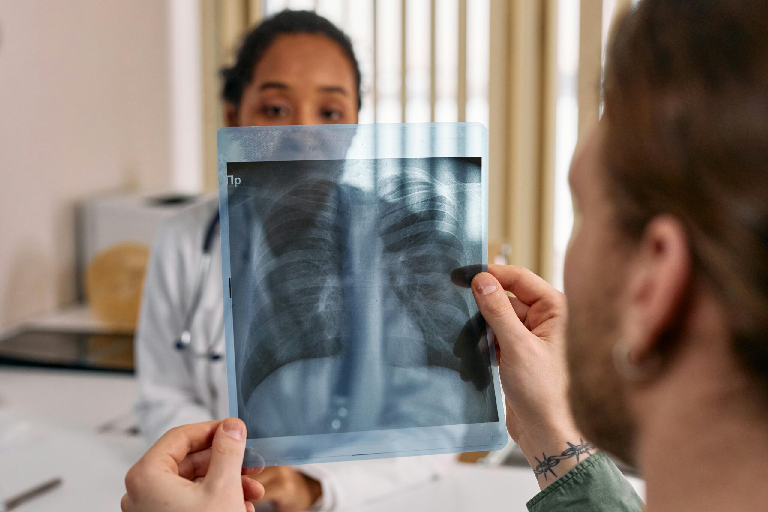 A doctor is looking at a lung x-ray A doctor is looking at a lung x-ray